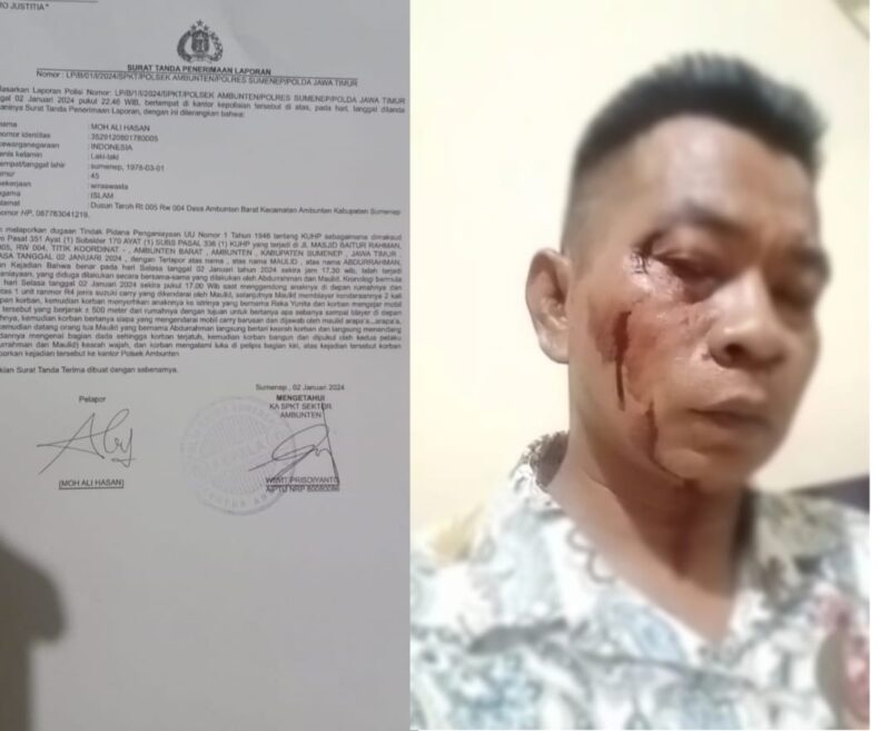 Jadi Korban Pengeroyokan Biadab 2 Oknum Ustad, Wartawan Sumenep Lapor Polisi